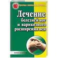 russische bücher: Сбитнева Е.М. - Лечение болезней ног и варикозного расширения вен