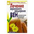 russische bücher: Андреева Е.А. - Лечение варикозного расширения вен проверенными народными рецептами