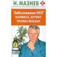 russische bücher: Мазнев Н. - Заболевания ног: варикоз, артрит, тромбофлебит