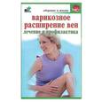 russische bücher: Орлова - Варикозное расширение вен