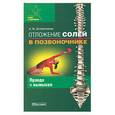 russische bücher: Долженков А.В. - Отложение солей в позвоночнике