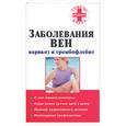 russische bücher:  - Заболевания вен: варикоз и тромбофлебит
