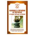 russische bücher: Мишинькин - Камни в печени и почках Лучшие методы лечения