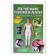 russische bücher: Геращенко Л.Л., Никонов Г.И. - Лечение пиявками в домашних условиях