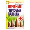 russische bücher: Родимин - Лечение чертовым пальцем