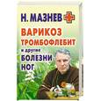 russische bücher: Мазнев Н. - Варикоз, тромбофлебит и другие болезни ног