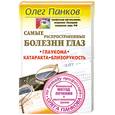 russische bücher: Панков О.П. - Самые распространенные болезни глаз. Глаукома. Катаракта. Близорукость