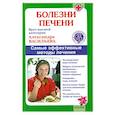 russische bücher: Васильева А. - Болезни печени. Самые эффективные методы лечения