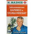 russische bücher: Н.И. Мазнев - Заболевания вен. Варикоз и тромбофлебит. 7 авторских методик