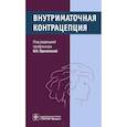 russische bücher: Прилепс - Внутриматочная контрацепция