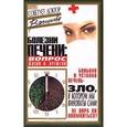 russische bücher: Александра Васильева - Болезни печени: вопрос жизни и… времени