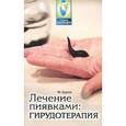 russische bücher: Буров М. - Лечение пиявками: гирудотерапия