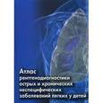 russische bücher: М. Костюченко - Атлас рентгенодиагностики острых и хронических неспецифических заболеваний легких у детей