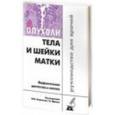 russische bücher: Андреева Юлия Юрьевна - Опухоли тела и шейки матки
