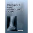 russische bücher: Миронова С.П. - Повреждения в зоне голеностопного сустава (+ CD-ROM)