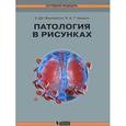 russische bücher: Финлейсон К., Ньюэлл Б. - Патология в рисунках