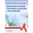 russische bücher: Зимина Вера Николаевна - Диагностика и лечение туберкулеза в сочетании с ВИЧ-инфекцией
