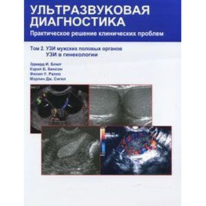 russische bücher: Блют Эдвард И. - Ультразвуковая диагностика. Практическое решение клинических проблем. В 5 томах. Том 2. УЗИ мужских половых органов. УЗИ в гинекологии