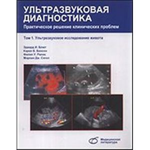 russische bücher: Блют Эдвард И. - Ультразвуковая диагностика. Практическое решение клинических проблем. Том 1. Ультразвуковое исследование живота