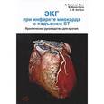 russische bücher: Байдес де Луна А. - ЭКГ при инфаркте миокарда с подъемом ST