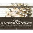 russische bücher: Полякова - Атлас электроэнцефалограмм детей с различной патологией головного мозга