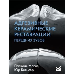 russische bücher: Манье П. - Адгезивные керамические реставрации передних зубов