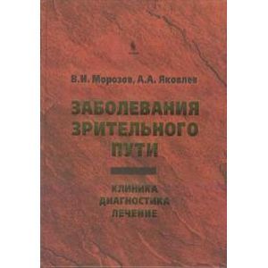 russische bücher: Морозов В.И., Яковлев А.А. - Заболевания зрительного пути