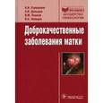 russische bücher: Стрижаков Александр Николаевич - Доброкачественные заболевания матки