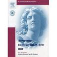 russische bücher:  - Лечение варикозных вен ног (+DVD)
