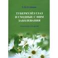 russische bücher: Устинова Елена Ивановна - Туберкулез глаз и сходные с ним заболевания. Руководство для врачей