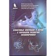 russische bücher: Лоран О. Б. - Слинговые операции у детей с пороками развития