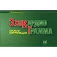 russische bücher: Струтынский А.В. - Эхокардиограмма. Анализ и интерпретация