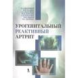 russische bücher: Молочков Владимир Алексеевич - Урогенитальный реактивный артрит