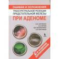 russische bücher: Сергиенко Николай Федорович - Ошибки и осложнения трансуретальной резекции предстательной железы при аденоме