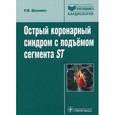 russische bücher: Шахнович Роман Михайлович - Острый коронарный синдром с подъемом сегмента ST. Руководство для врачей