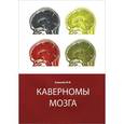 russische bücher: Кивелев Юрий Вдладимирович - Каверномы мозга
