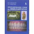 russische bücher: Робустова Татьяна Григорьевна - Протезирование зубов на имплантатах