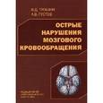 russische bücher: Трошин В.Д. - Острые нарушения мозгового кровообращения