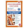 russische bücher: Попова Ю. - Заболевания сосудов. Лучшие методы лечения