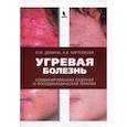 russische bücher: Демина О.М., Картелишев А.В. - Угревая болезнь. Комбинированная лазерная и фотодинамическая терапия