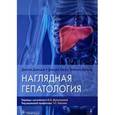 russische bücher: Джоши Д. - Наглядная гепатология. Учебное пособие