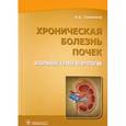 russische bücher: Томилина Наталья Аркадьевна - Хроническая болезнь почек. Избран.главы нефрологии