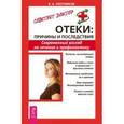 russische bücher: Плотников В. - Отеки: причины и последствия. Современный взгляд на лечение и профилактику