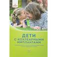 russische bücher: Кукушкина Ольга ,Бахшинян В.,Гончарова Е. Л. - Дети с кохлеарными имплантами