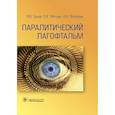 russische bücher: Груша Я., Федоров Анатолий Александрович,  Фетцер Елена Игоревна - Паралитический лагофтальм