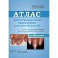 russische bücher: Бэран Роберт, Ханеке Экарт - Дифференциальная диагностика поражений ногтей. Атлас