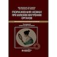 russische bücher: Заславский Д.,Сыдиков А.,Охлопков В. и др. - Поражения кожи при болезнях внутренних органов. Иллюстрированное руководство для врачей