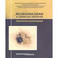 russische bücher: Алиев Мамедьяр Джавадович - Меланома кожи и слизистых оболочек. Клинические рекомендации