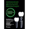 russische bücher: под.ред.Фроума Стюарта Дж. - Осложнения дентальной имплантации.Этиология,профилактика и лечение