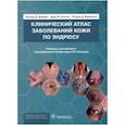 russische bücher: Джеймс Уильям Д. - Клинический атлас заболеваний кожи по Эндрюсу